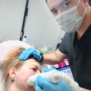Microneedling (Estimulación del colágeno)